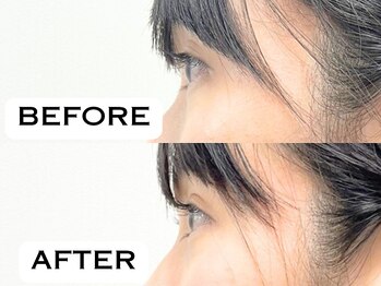 ビハリスト 恵比寿/目の開きに変化が!