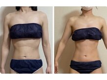 リュミエール(umiere)/ウエストラインが変わりました