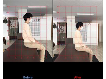 ストレチックス 近江八幡店/BeforeAfter