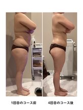 グレッシュ &nbsp;弘前店(Gresh)/★お客様のビフォーアフター★