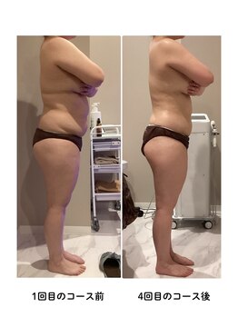 グレッシュ &nbsp;弘前店(Gresh)/★お客様のビフォーアフター★