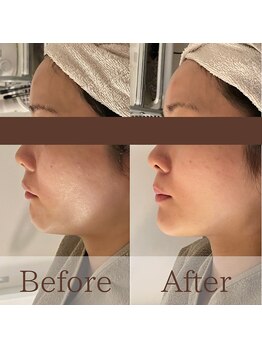 凪眠/小顔リンパフェイシャルの効果55