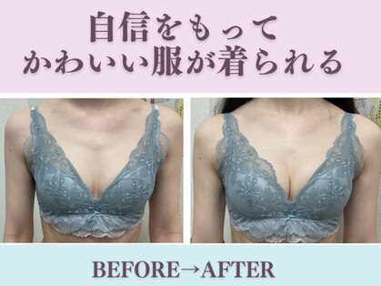 バーディー(BIRDIE)の写真