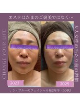 リラブルー(Lilas Bleu)/2年間サロンケアを続けると