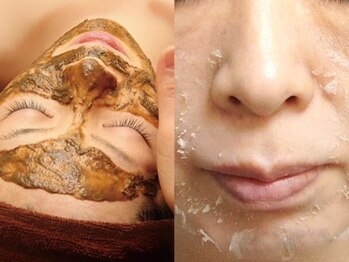 ブリリアンス(Brilliance)の写真/【肌質改善】リベルハーブピーリングは棘状成分&天然ハーブで短期間で肌代謝促進、多様な肌悩みを根本改善