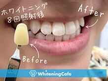 ホワイトニングカフェ 姫路駅前店(WhiteningCafe)/ホワイトニング8回照射
