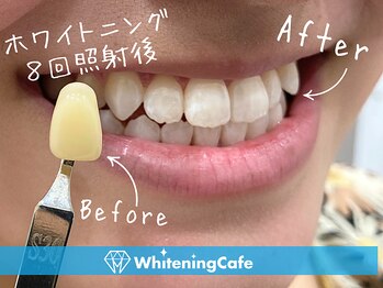 ホワイトニングカフェ 姫路駅前店(WhiteningCafe)/ホワイトニング8回照射