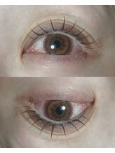 タイド バイ ホープ(tied by Hope)/【Wフラット100本】