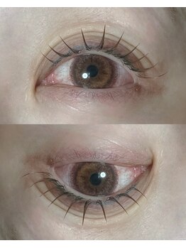 タイド バイ ホープ(tied by Hope)/【Wフラット100本】