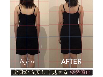 エメリリアビゼ 麻布十番(Aimerlilia bisser)の写真/【人気No.1｜40代からの姿勢美容】 全身×小顔BODYBEAUTY 105分