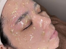 ヨイ(yoi)/HYDROJELLY MASK