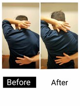 アース エンジェル整体院/ビフォアフ　肩甲骨はがし