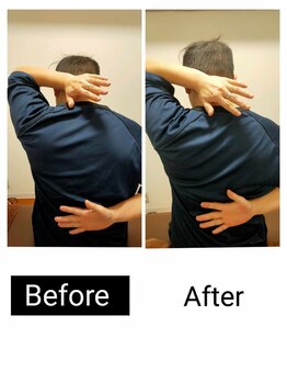 アース エンジェル整体院/ビフォアフ 肩甲骨はがし