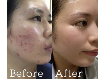 ヨサパーク リリ(YOSA PARK RIRI)/体の内側から輝く美肌へ☆