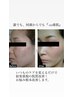 【1番人気!!速攻美白】強い日差しのダメージケアにも『肌質改善パック』