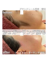 グランクレール トウキョウ(GRANDCLAIRE.TOKYO)/フェイスシュガーリング