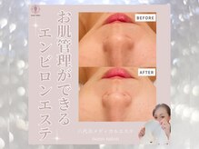 ノノサロン(nono salon)/モニター様