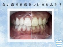 ドクターモック(Dr.MOC)