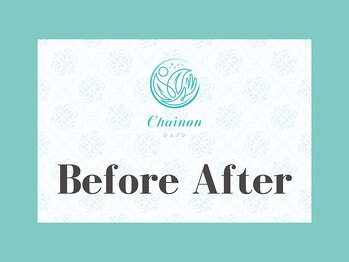 シェノン(Chainon)/* Before After