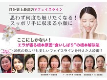 ラヴィ(Lavie)