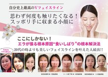 ラヴィ(Lavie)