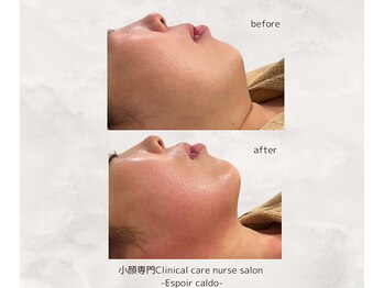 エスポワールカルド(Espoir caldo)/