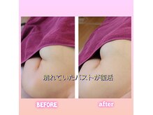 ベテランの技術＋光＋ナノカレント効果で戻らないバスト\14800