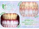 シカホワイトニングトウキョウ 笹塚店(CICA Whitening Tokyo)の写真