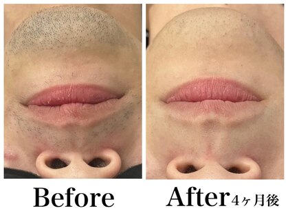 メンズビューティーハウス(Men-s Beauty House)の写真