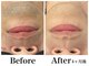メンズビューティーハウス(Men-s Beauty House)の写真