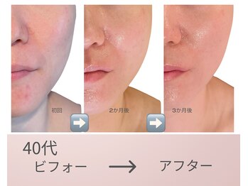 リアン(Lien)の写真/顔の大きさ、実は”顔コリ”かも。硬くなった筋肉をほぐしてスッキリバランスの整った小顔へ。左右差にも◎