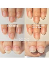ニコプラス(NICO+)/自爪育成パラジェルクリア補強