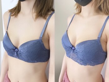 ヴィア 五反田(Via)/【バストアップ】20代前半お客様