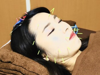 くにたちNyan鍼灸整体院/美容鍼で小顔美人へ♪