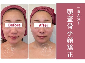 ビレナ 守谷店(Birena)/Birena式頭蓋骨小顔矯正