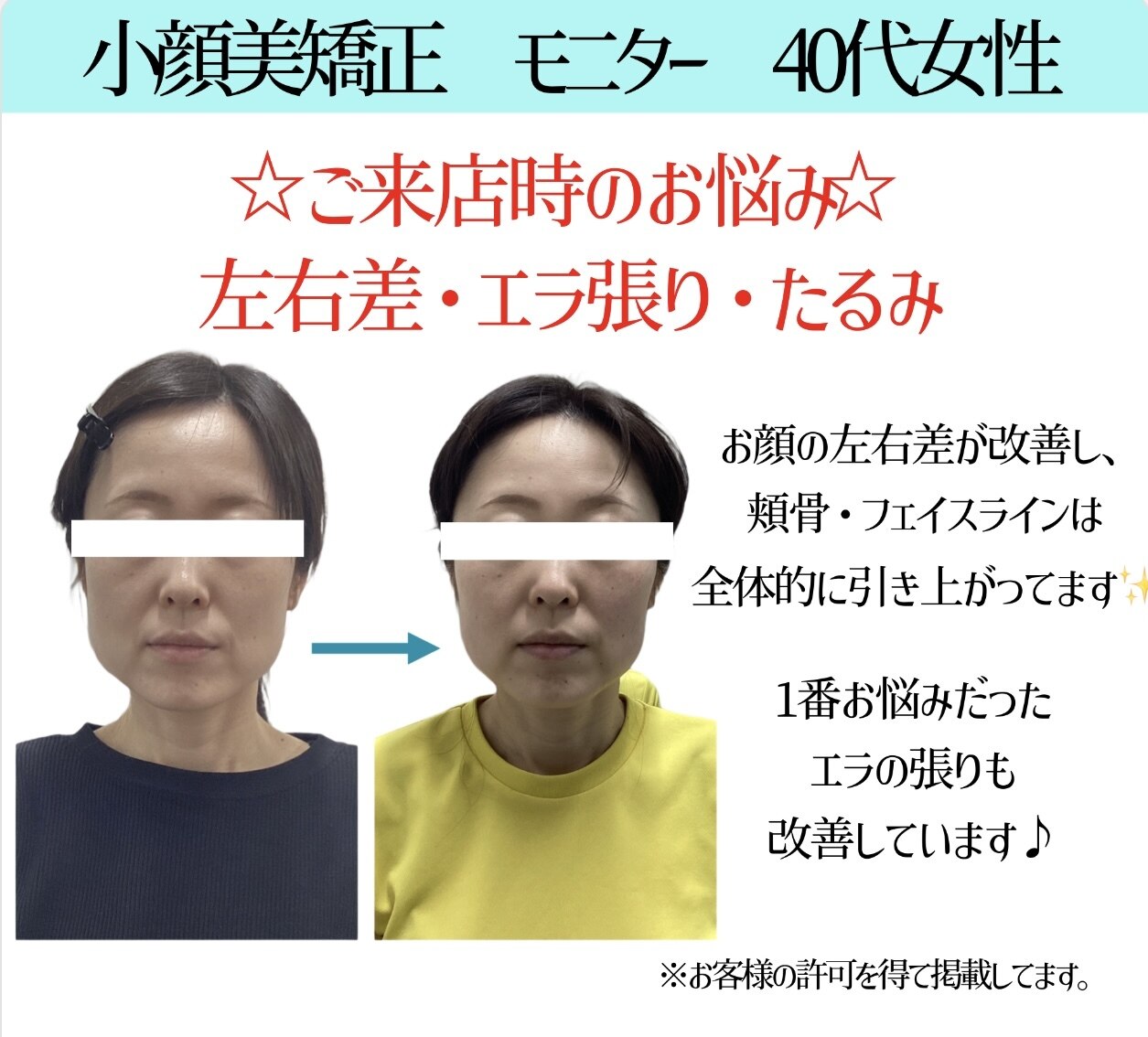 磯辺式瞬間小顔矯正とおまけ。 fit=scale-down,w=1200