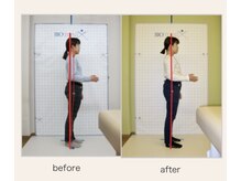 やまじ整骨院/40代女性/猫背矯正 &nbsp;施術事例