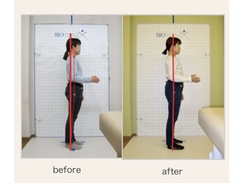 やまじ整骨院/40代女性/猫背矯正 &nbsp;施術事例