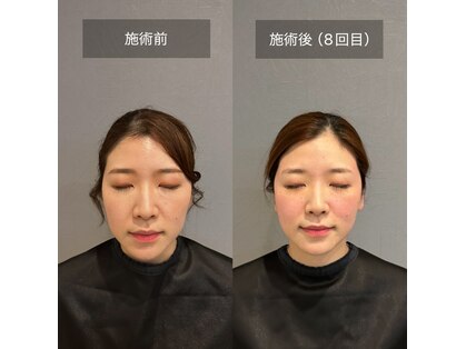 プライミー(PRIMY)の写真