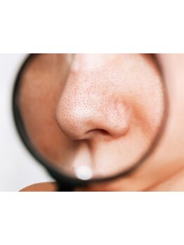 メンズフェイシャル