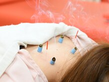 ほねつぎ ふじみ野はりきゅう接骨院/WHO認める鍼灸