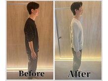 整体ラルース 中目黒(LALUZ)/20代 男性 猫背、姿勢改善　変化