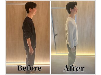 整体ラルース 中目黒(LALUZ)/20代 男性 猫背、姿勢改善 変化