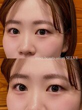 セルヴ(SELVE)/まつ毛お肌に優しいまつ毛パーマ