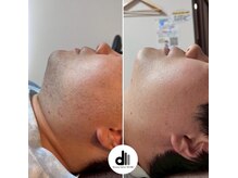 ビューティーサロン マル(Beauty Salon MARU)/