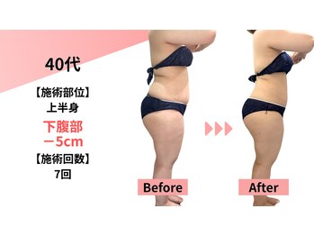 クレビア(Clevia)/Clevia-クレビア