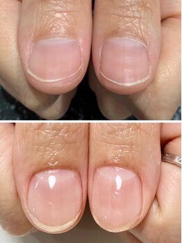 EOQCの写真/爪を見せるのが恥ずかしい…そんな爪の悩み解消、美爪育成サロン☆健康で美しいお爪に◎