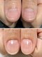 EOQCの写真/爪を見せるのが恥ずかしい…そんな爪の悩み解消、美爪育成サロン☆健康で美しいお爪に◎
