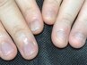 噛み爪、深爪ケア3回コース27500円☆自爪育成！