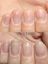 マリーロール 梅田店(Marie Laure)/自爪育成/深爪矯正/ネイルケア